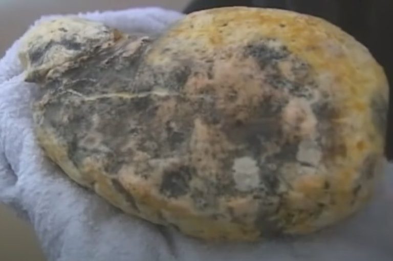 Félmillió euró értékű „lebegő aranyat” találtak egy elpusztult bálna emésztőrendszerében